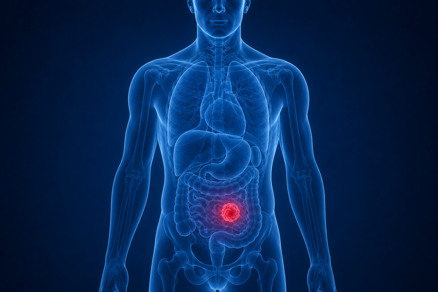 abdominal meta