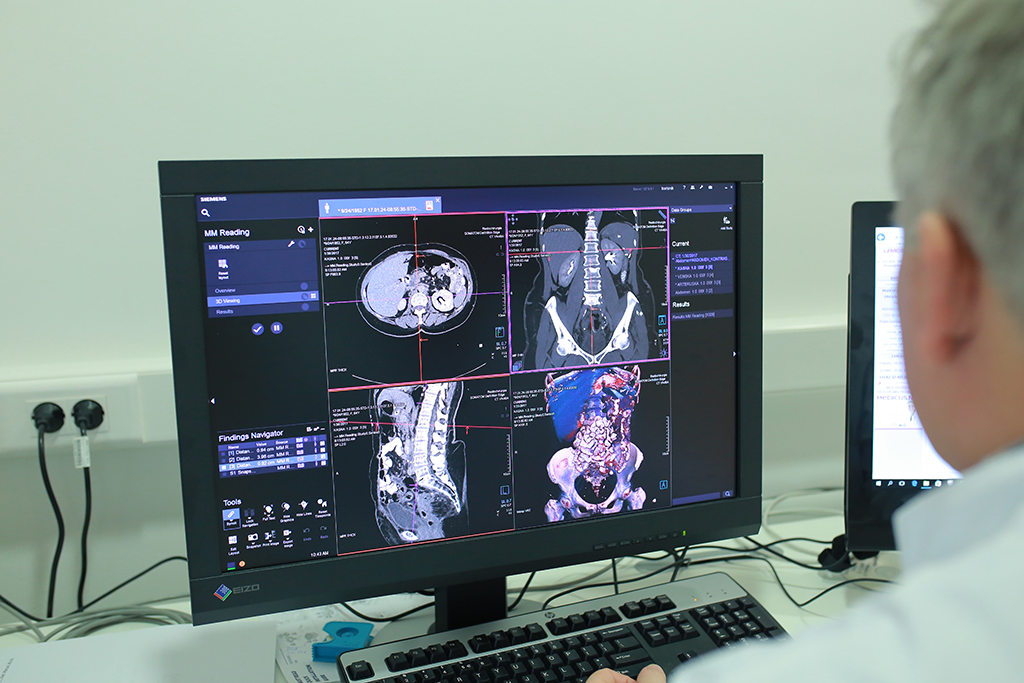 Radiochirurgia Zagreb prva u Europi koristi najmoderniju tehnologiju za liječenje karcinoma gušterače